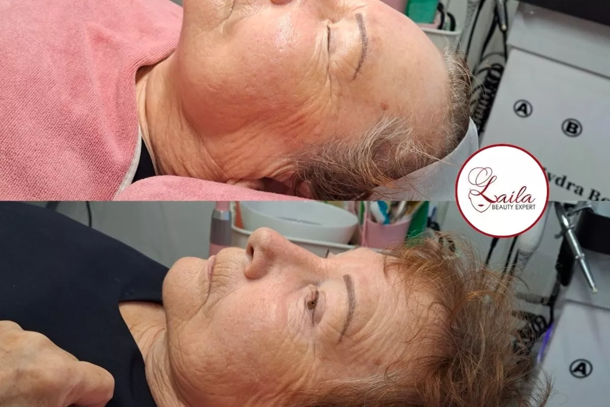 Protocole soin visage expert Bois-Guillaume