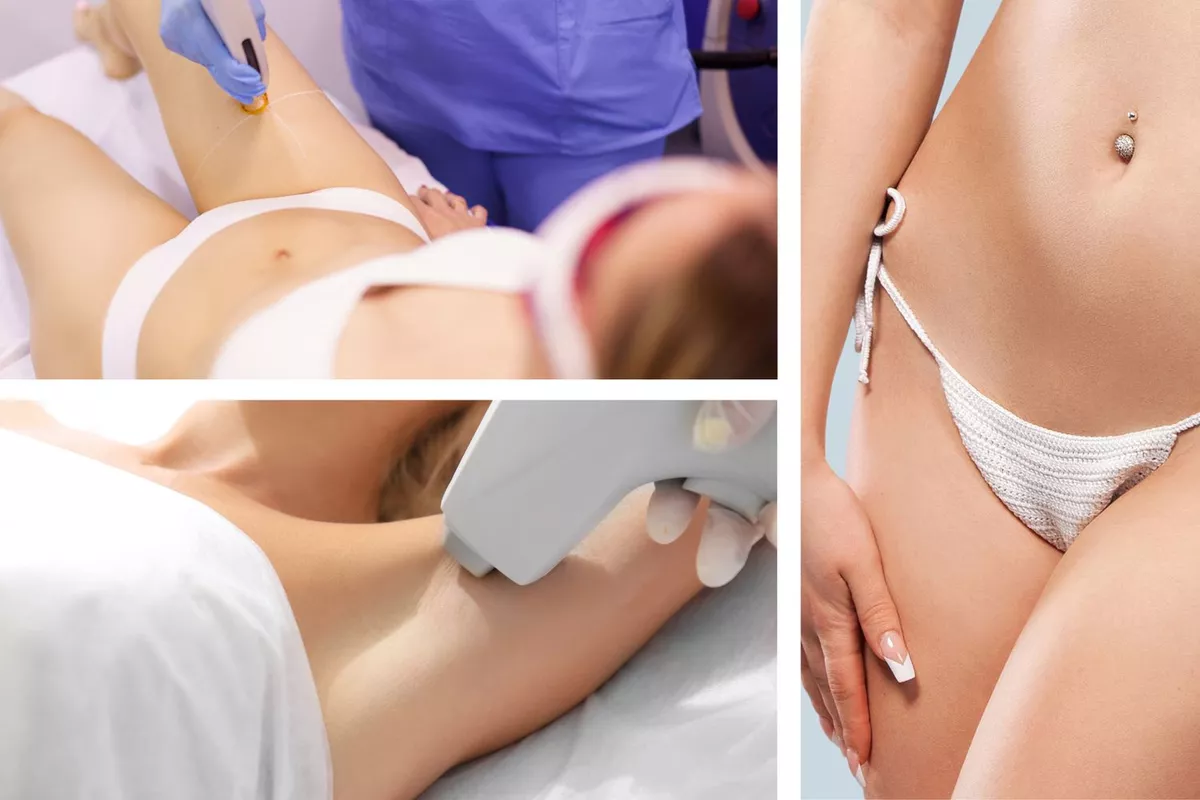 Épilation Laser - Jambes entières + Maillot intégral + Aisselles + SIF, Lèvre ou Menton offert