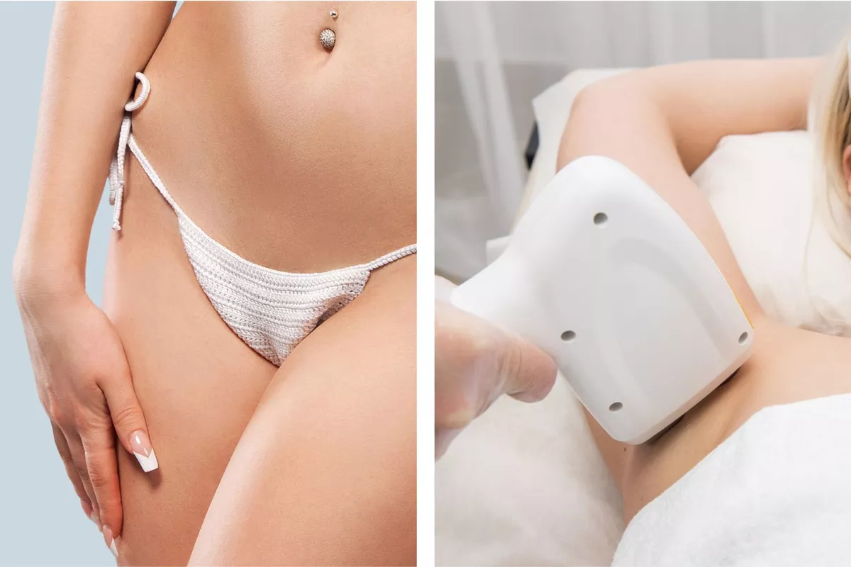 Épilation Laser - Maillot intégral + Aisselles + SIF offert