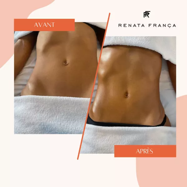 Drainage lymphatique pour ventre plat
