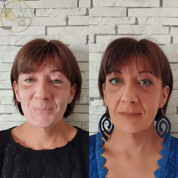 Maquillage sur une cliente atteinte de vitiligo