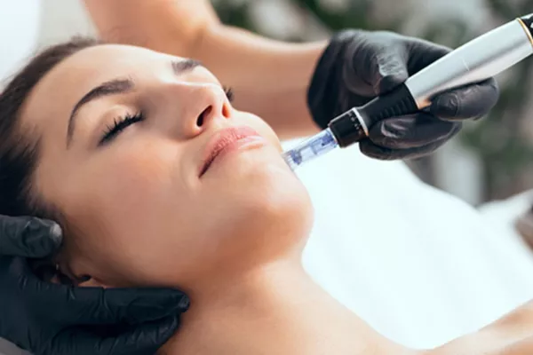Microneedling - Cicatrice Luminothérapie