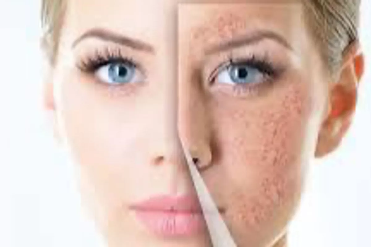 Essentiel Purifiant ( nettoyage de la peau en profondeur )