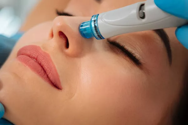 Hydro-microdermabrasion