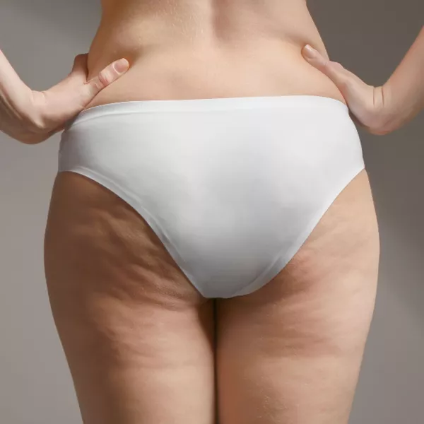 Crème anti-cellulite amincissante pour traitement efficace et raffermissant du corps
