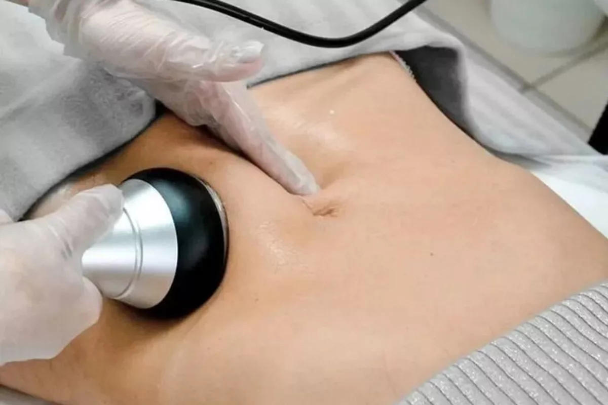 Cure Lipo+RF 1 zone 5 Séances