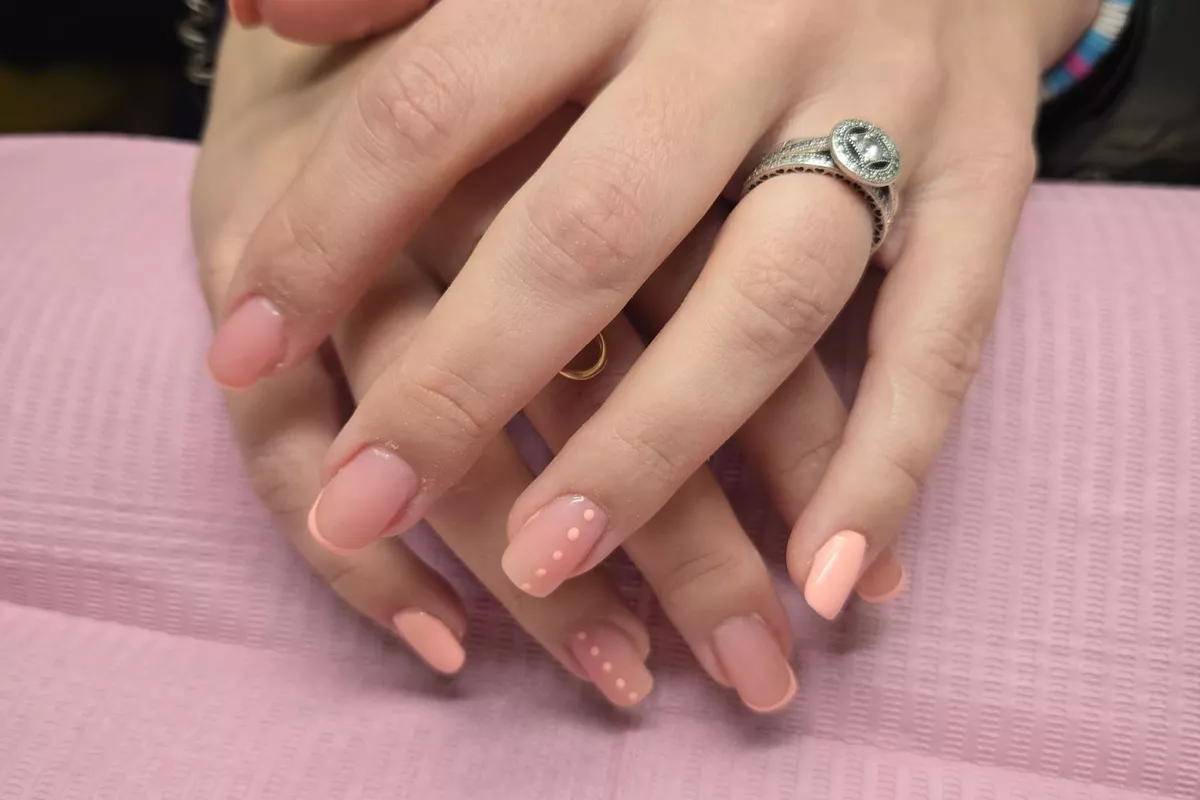 Remplissage gel ou résine 6 semaines