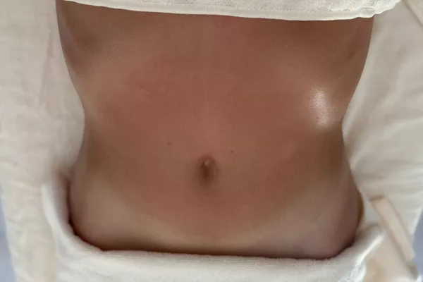 Drainage Lymphatique corps entier (spécial ventre ballonné)