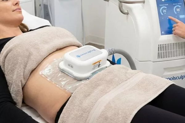 Séance de cryolipolyse – 2 zones traitées