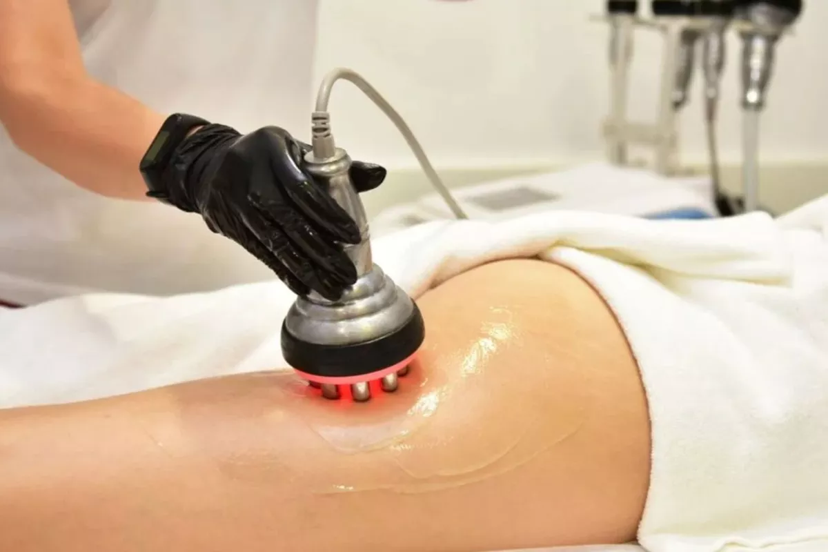 Lipocavitation