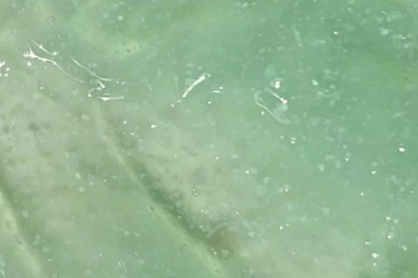 Soin Minceur Anti-cellulite