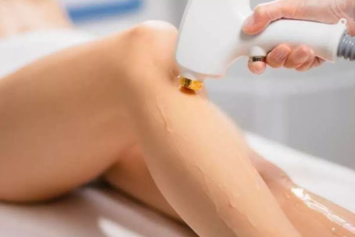 Épilation laser diode : Demi-jambes