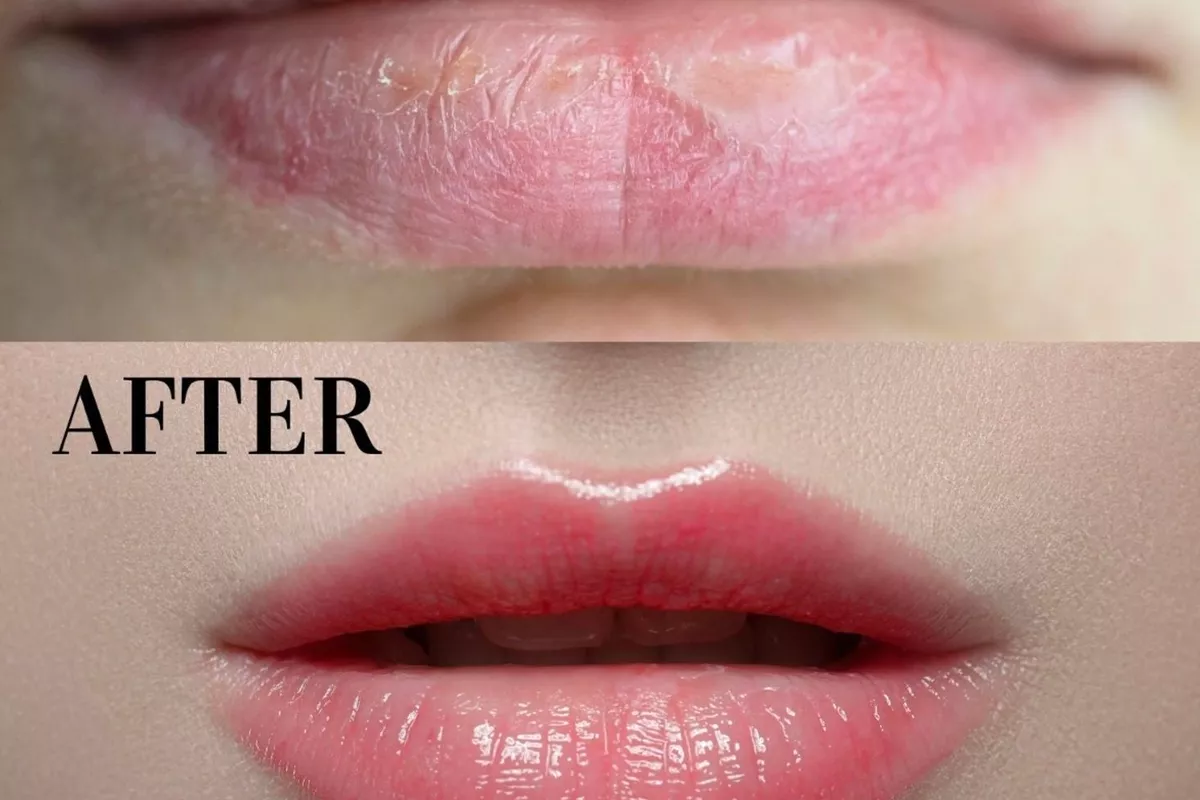 Soins Anti-tâches Bois-Guillaume