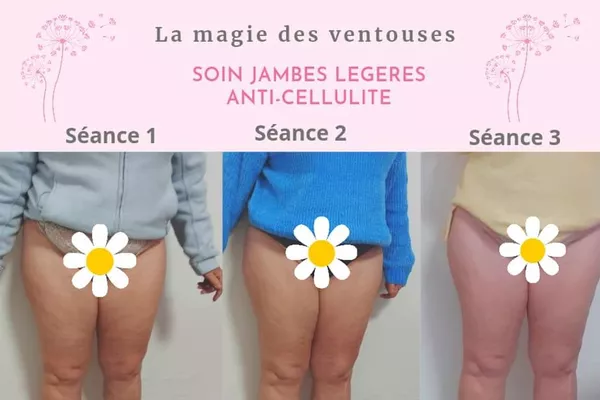 Forfait 6, 12 ou 20  séances jambes légères & anti-cellulite et raffermissant