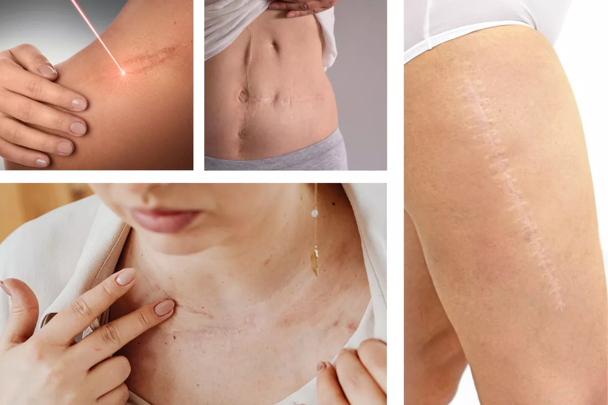 Dermo-pigmentation réparatrice