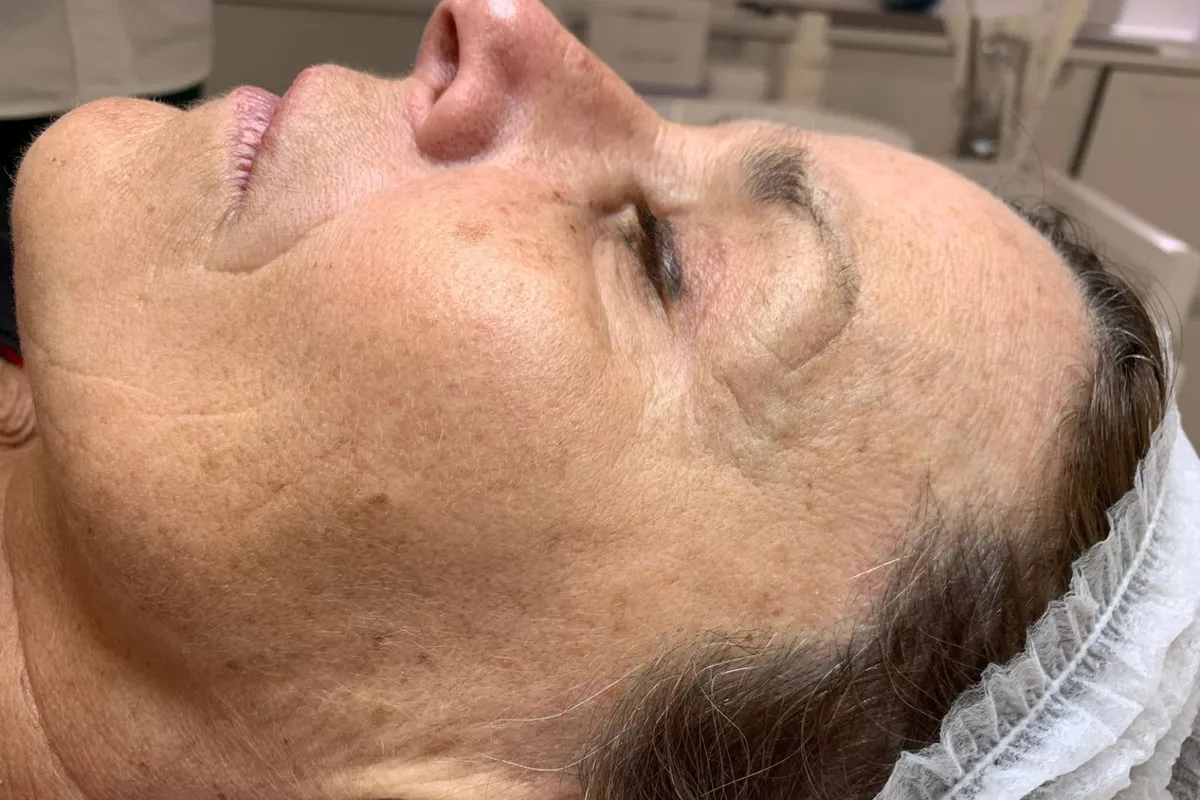 Premier diagnostic Peau & Visage