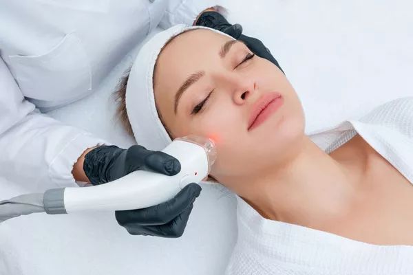 Épilation définitive visage au laser diode – Joues