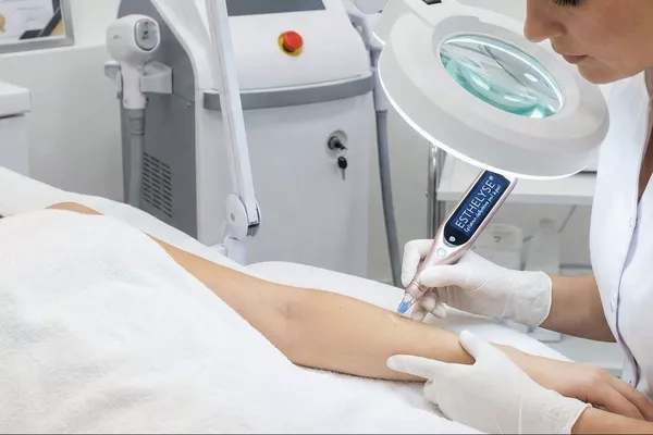 Séance 30min - Épilation définitive poil à poil (Esthelyse)