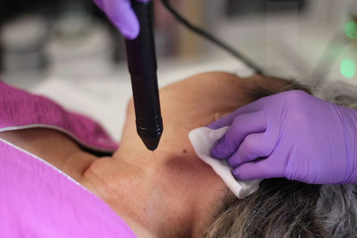 Plasma Froid Russe Cou