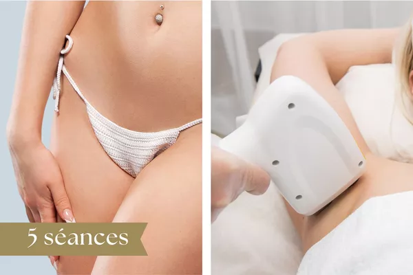 Forfait Épilation Laser 5 séances : Maillot intégral + Aisselles