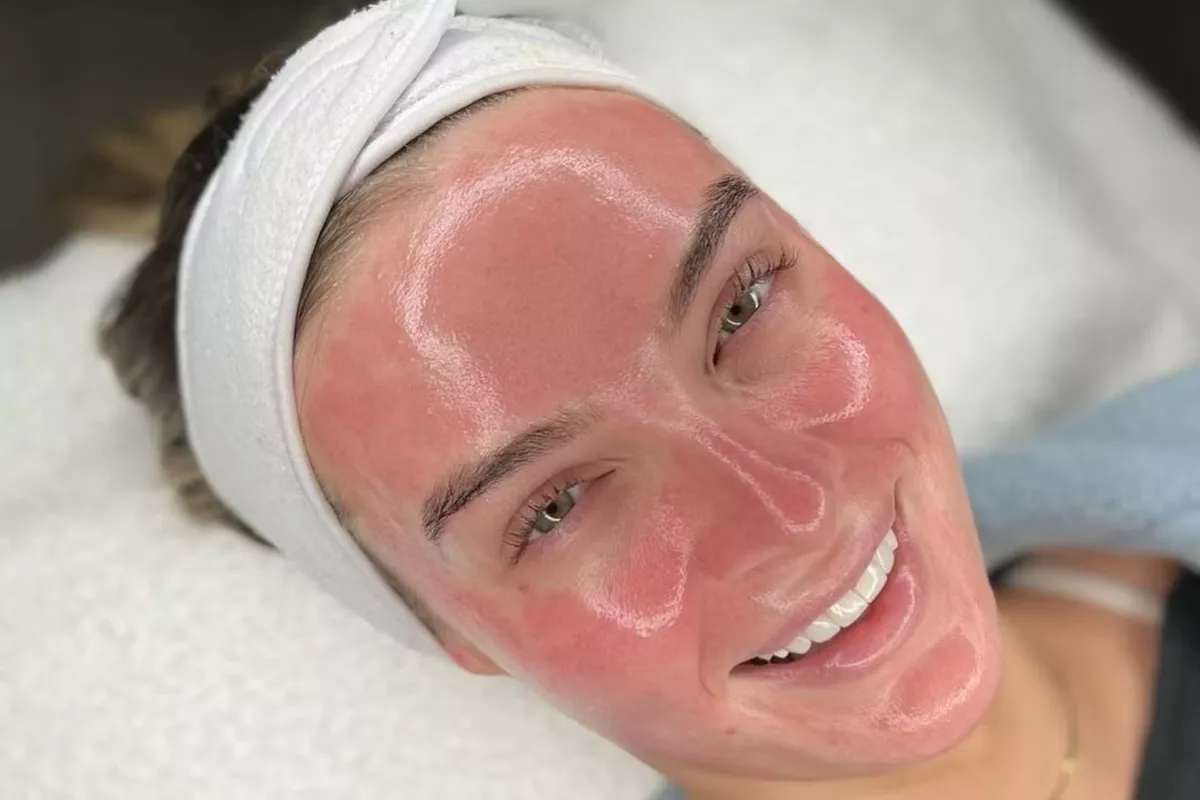 Peeling Bois-Guillaume