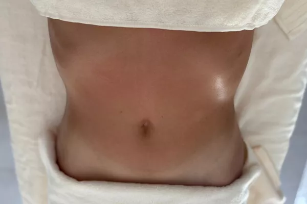 Drainage Lymphatique corps entier (spécial ventre ballonné)