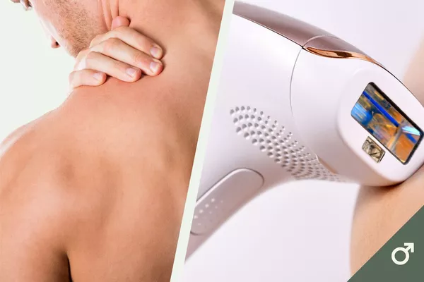 Épilation définitive IPL - Épaules pour homme