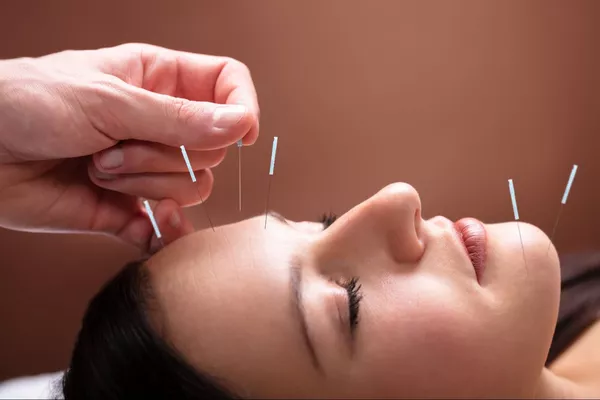 Rappel Aculifting