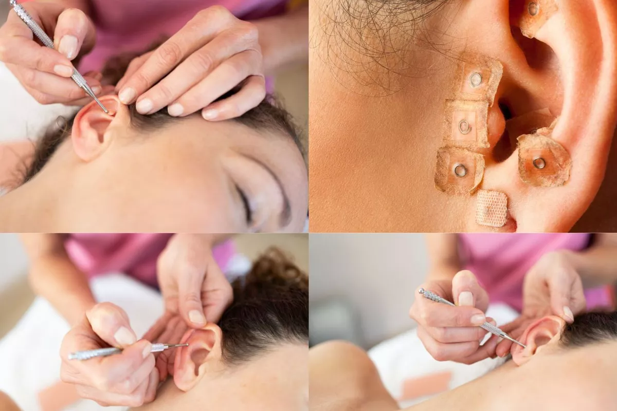 Séance d’auriculothérapie (réflexologie auriculaire), adaptée aux hommes ,femmes et adolescents , (excluant les nourrissons, femmes enceinte et enfants de - 13ans )